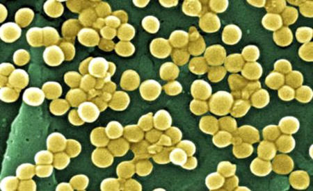 “超级病菌”现南亚 可抵御所有抗生素