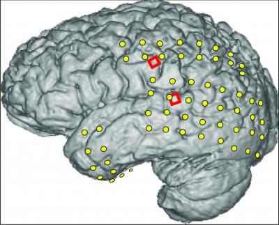 美科学家成功将大脑信号翻译成口语单词(图)