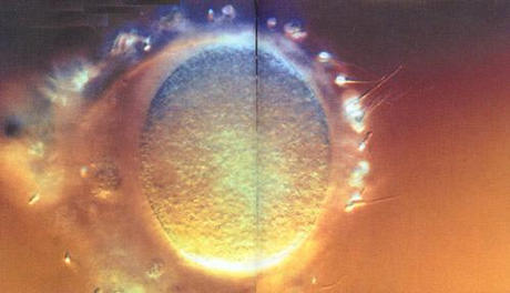组图：窥探精子与卵子结合至受孕全过程