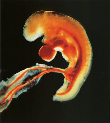组图：窥探精子与卵子结合至受孕全过程(2)